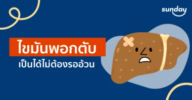 โรคไขมันพอกตับ