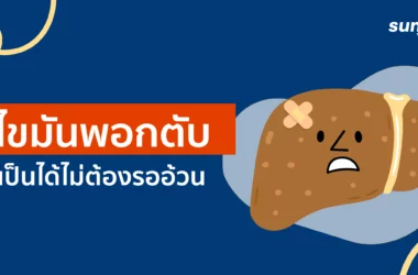 โรคไขมันพอกตับ