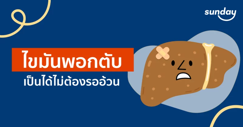 โรคไขมันพอกตับ